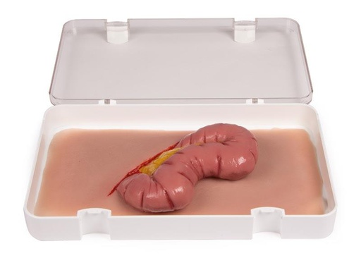 [24688-01] ERLERZIMMER Wound Moulage Large Intestine Evisceration