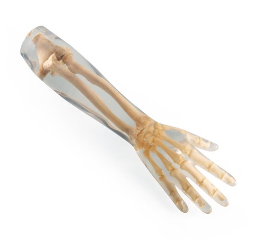 [24708-01] ERLERZIMMER Röntgenphantom Unterarm, transparent