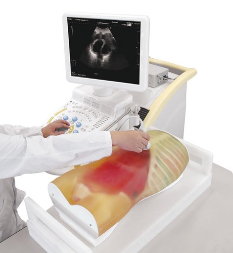[24715-01] ERLERZIMMER FAST Ultrasound Examination Model