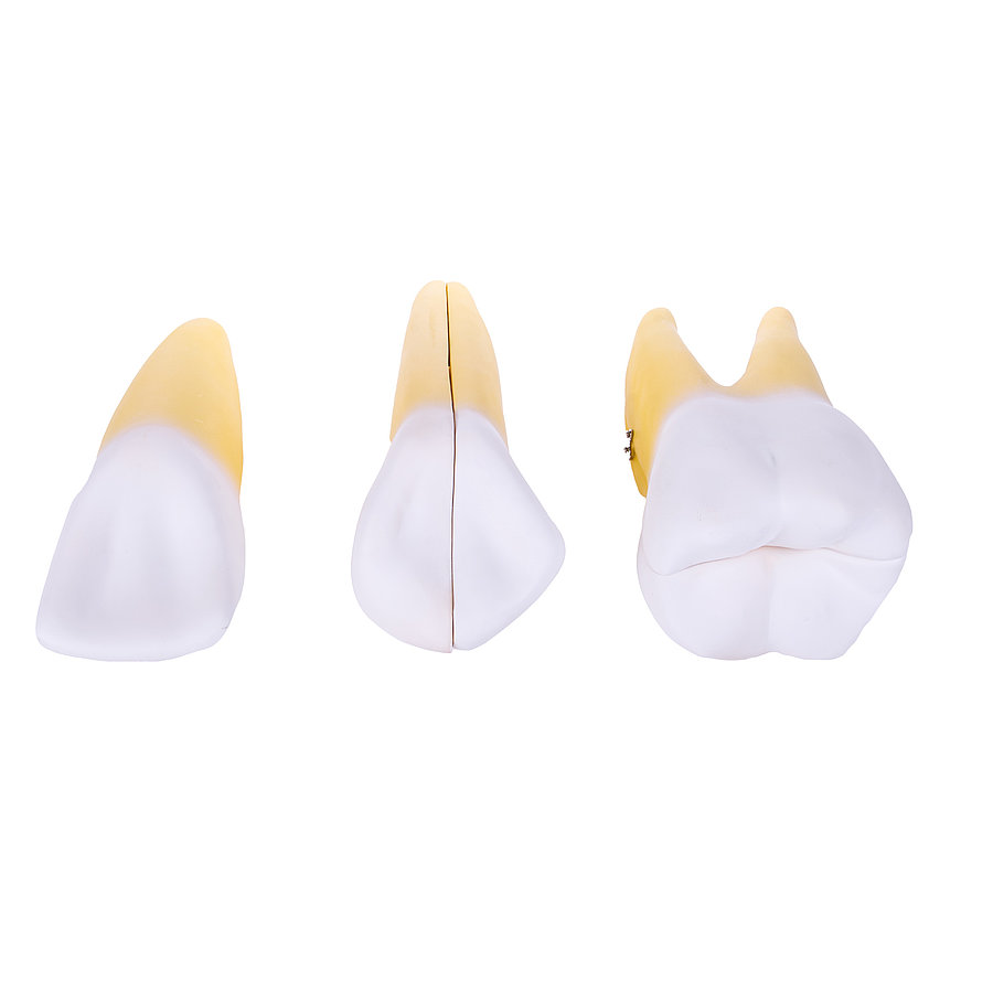 HEINESCIENTIFIC Dismountable tooth model, 3-piece set
