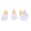 HEINESCIENTIFIC Dismountable tooth model, 3-piece set