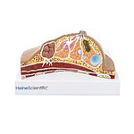 HEINESCIENTIFIC Brustmodell mit Erkrankungen