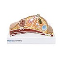 HEINESCIENTIFIC Brustmodell mit Erkrankungen