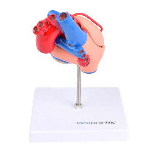 [27067-01] HEINESCIENTIFIC Bypass model