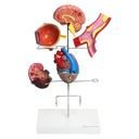 HEINESCIENTIFIC Modell der Hypertonie-Folgen