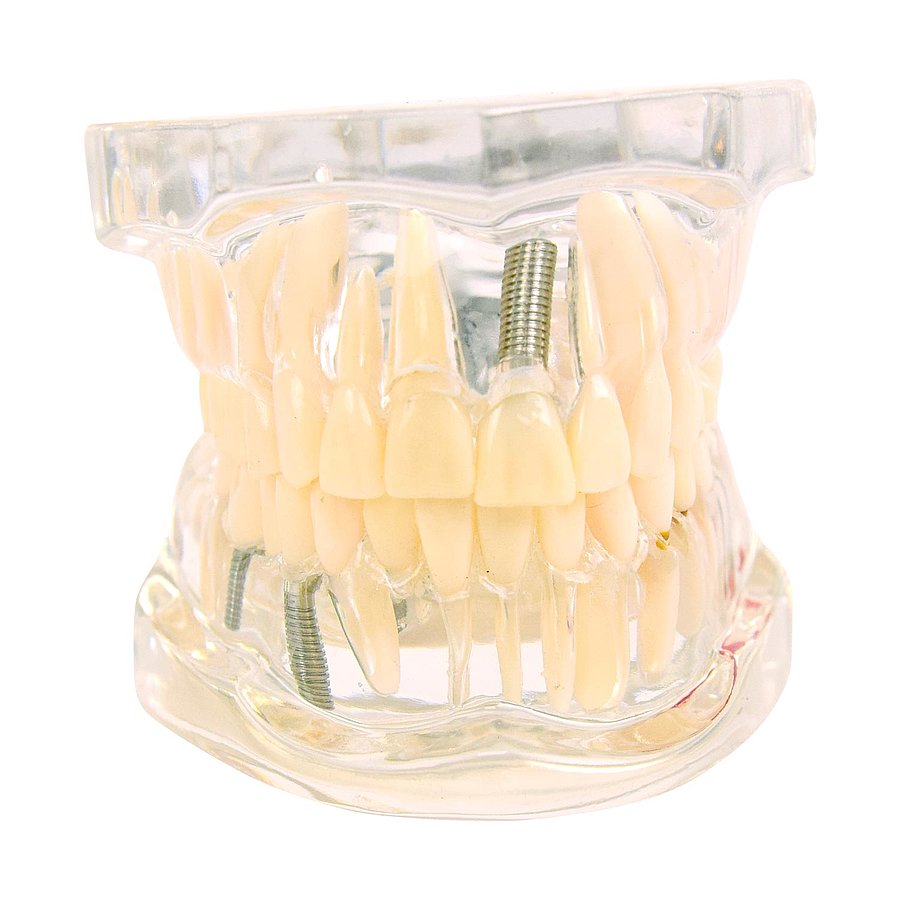 HEINESCIENTIFIC Transparent jaw model / Adult dentition