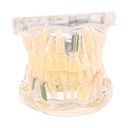HEINESCIENTIFIC Transparent jaw model / Adult dentition