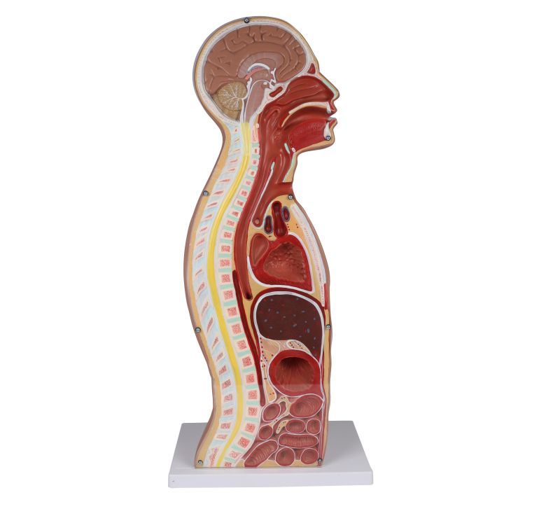 ERLERZIMMER NG & Tracheostomie Torso, lebensgroß