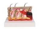 ERLERZIMMER Pathologisches Hautmodell mit Verbrennung, 30-fache Größe