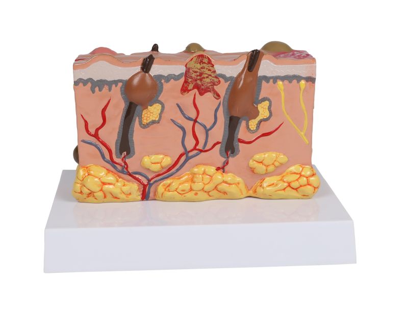 ERLERZIMMER Pathologisches Hautmodell