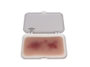 ERLERZIMMER Wound Moulage Hematoma Fresh