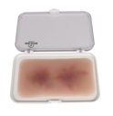 ERLERZIMMER Wound Moulage Hematoma Older