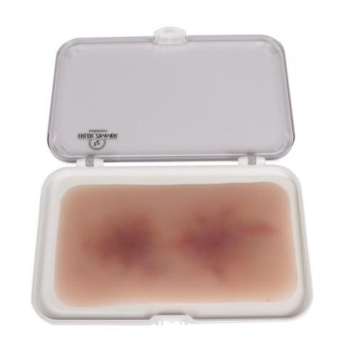 [27403-01] ERLERZIMMER Wound Moulage Hematoma Older