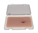 ERLERZIMMER Wundmoulage Stich Oberschenkel