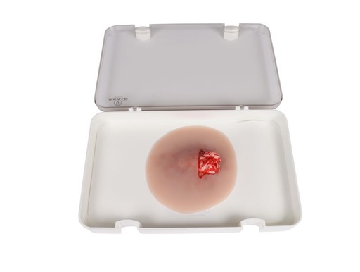 [27410-01] ERLERZIMMER Wound Simulation Open Fracture Ankle Joint