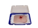 ERLERZIMMER Wundmoulage Schuß Leiste, Wound Packing