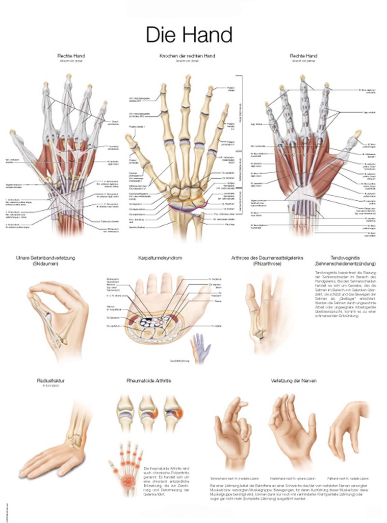 ERLERZIMMER Anatomische Lehrtafel Die Hand