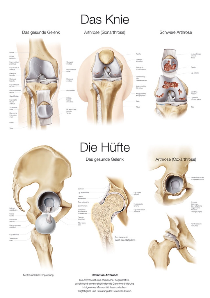 ERLERZIMMER Anatomische Lehrtafel Das Knie und Die Hüfte
