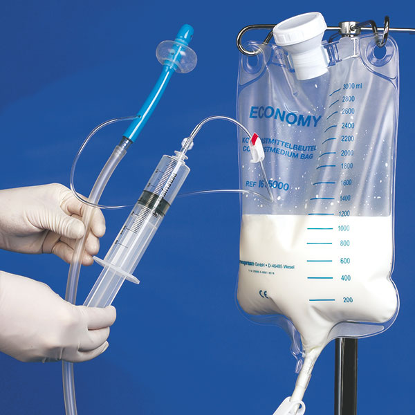 DCT Bowel Irrigation System - closed non-sterile