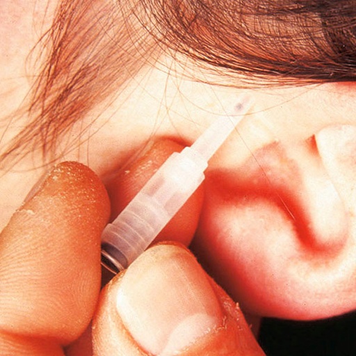 [16812-01] Ear acupuncture needles ASP